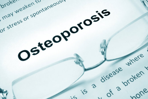 Tips on How to Manage Osteoporosis